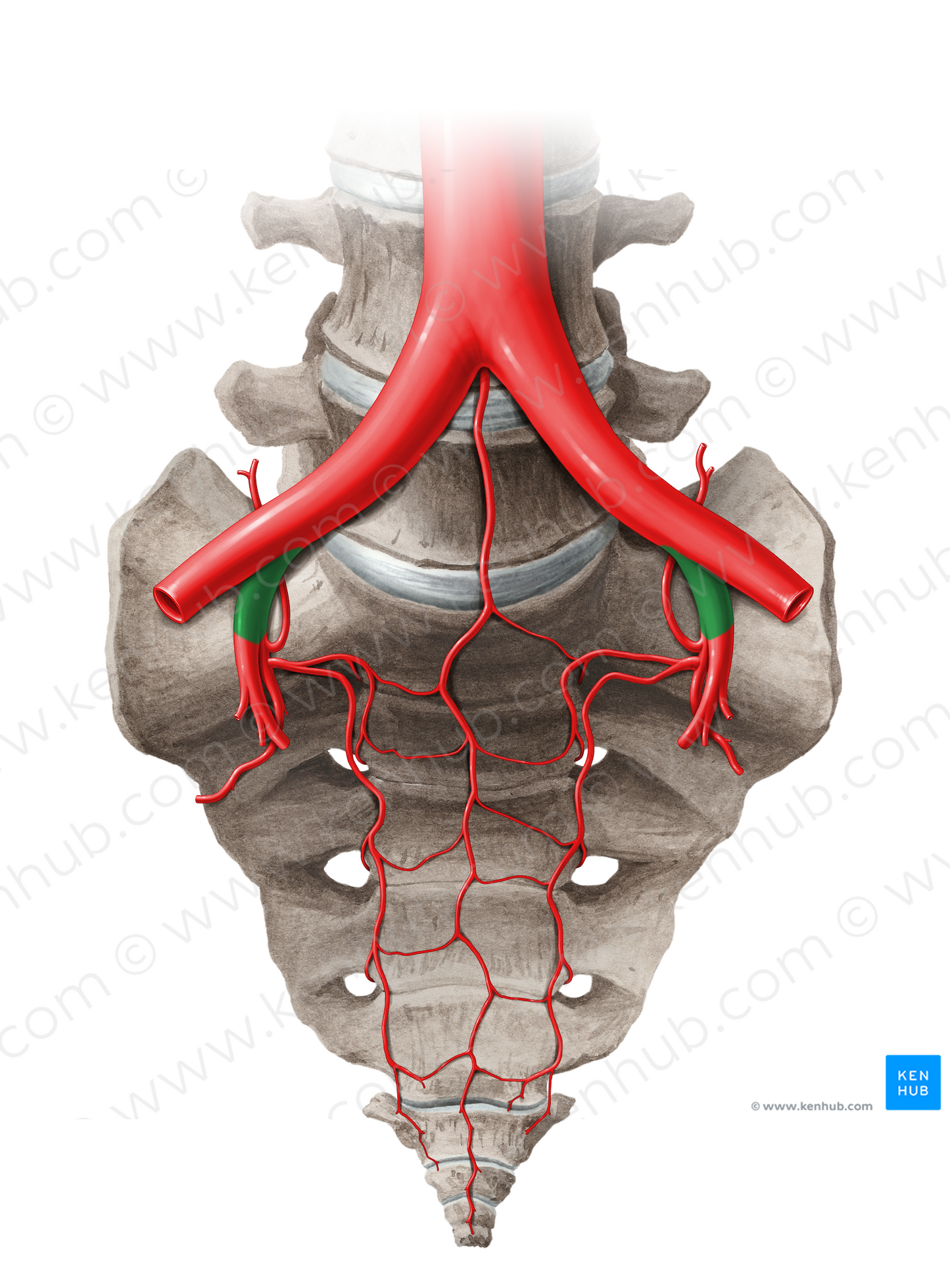 Internal iliac artery (#14055)