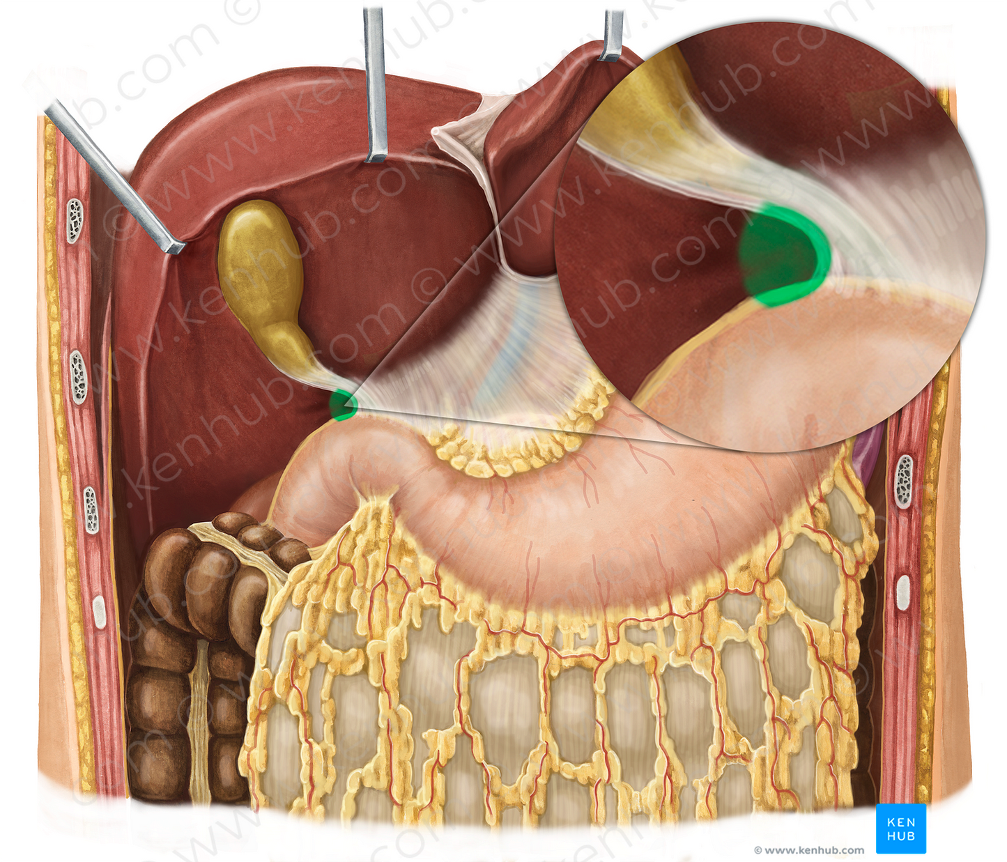 Omental foramen (#3785)