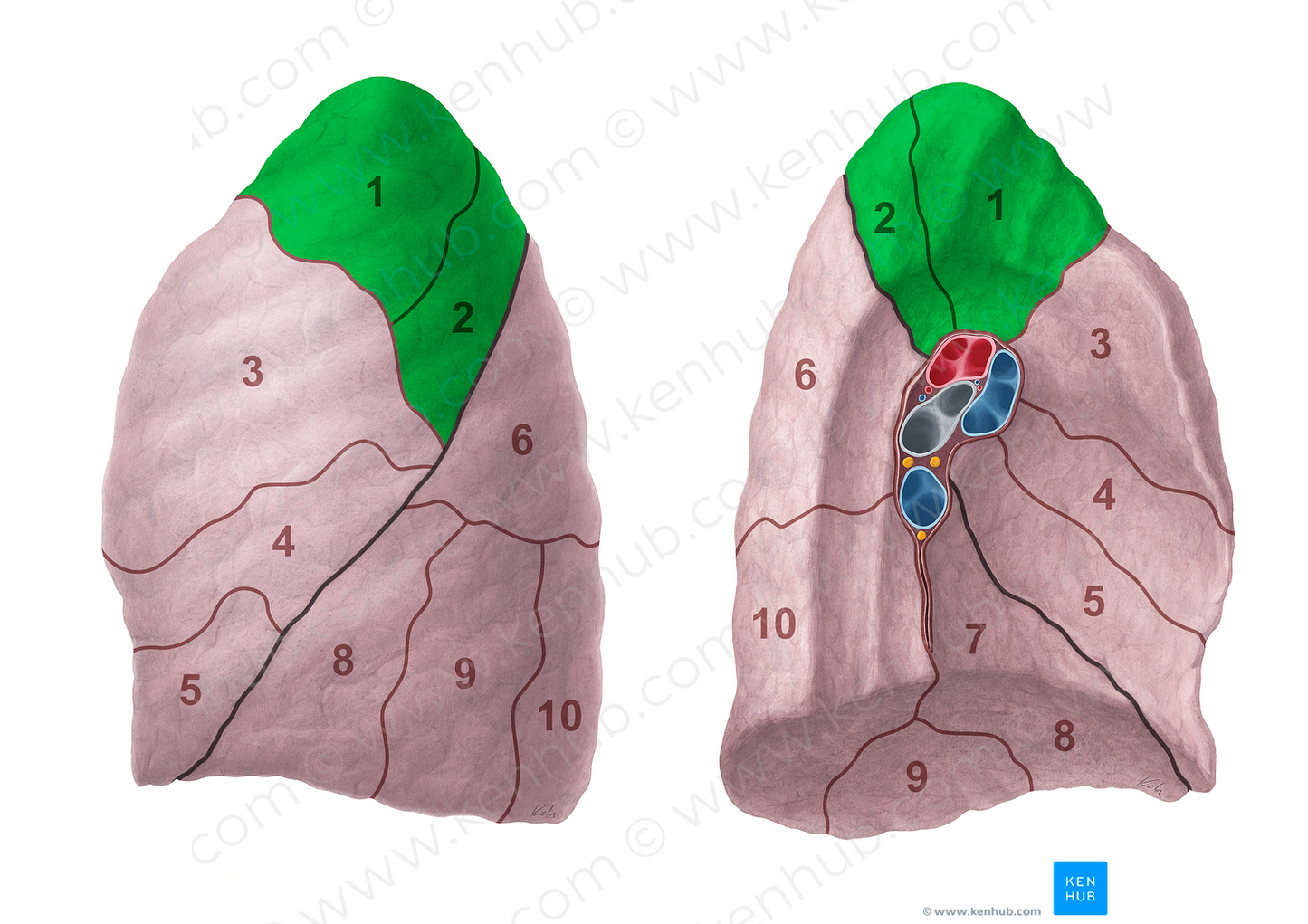 Apicoposterior segment of left lung (#20698)