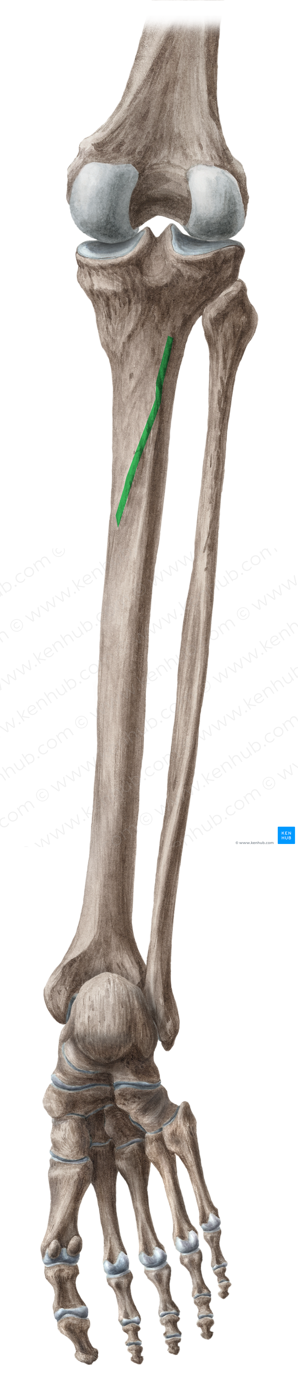 Soleal line of tibia (#4705)