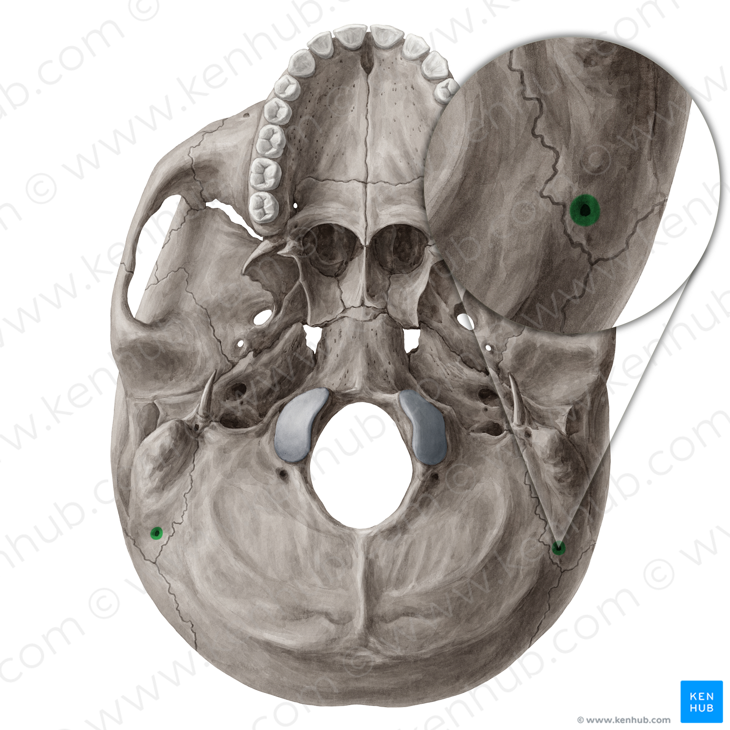 Mastoid foramen (#3771)