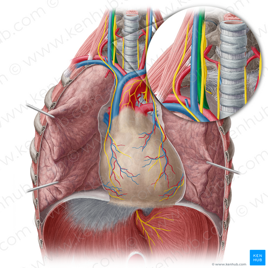 Right common carotid artery (#937)