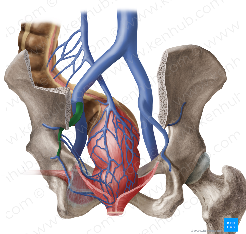 Left internal iliac vein (#10329)