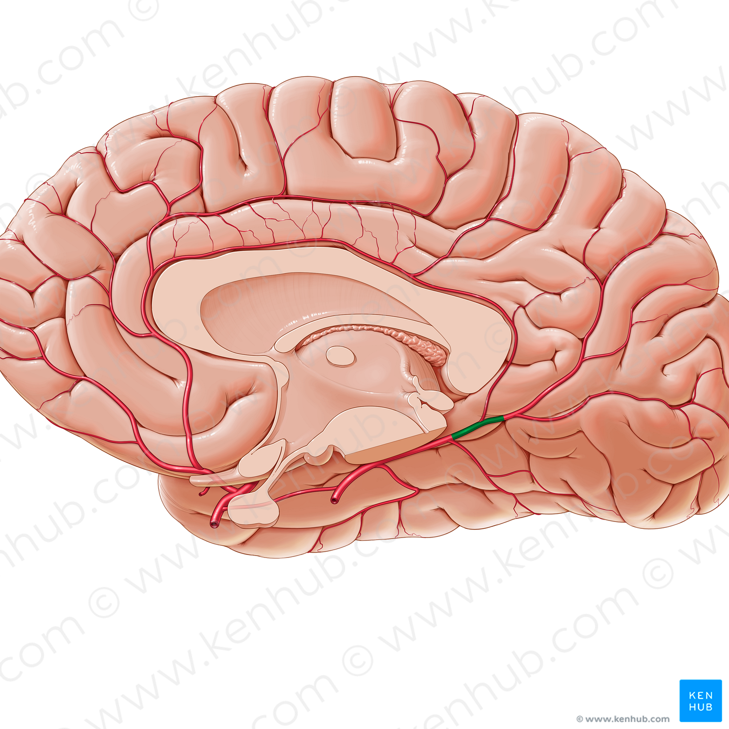 Medial occipital artery (#1566)