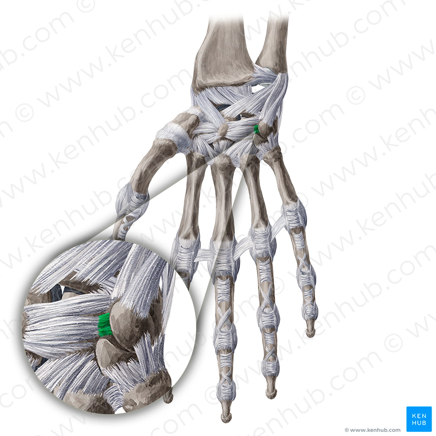 Palmar triquetrohamate ligament (#20660)