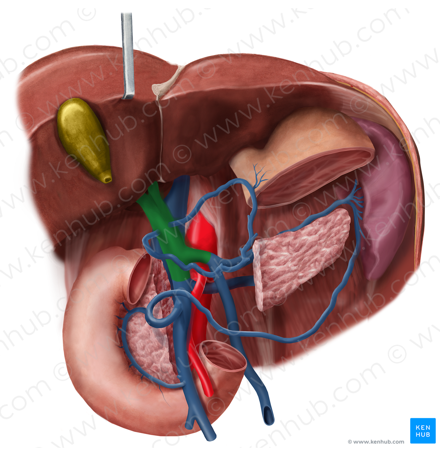 Hepatic portal vein (#10483)