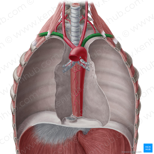 Subclavian artery (#1809)