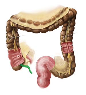 Vermiform appendix (#795)