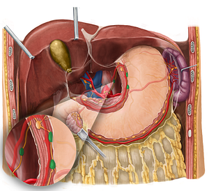 Left gastric lymph nodes (#6998)