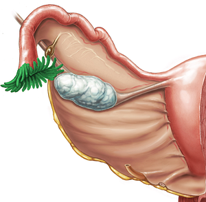 Fimbriae of uterine tube (#3644)