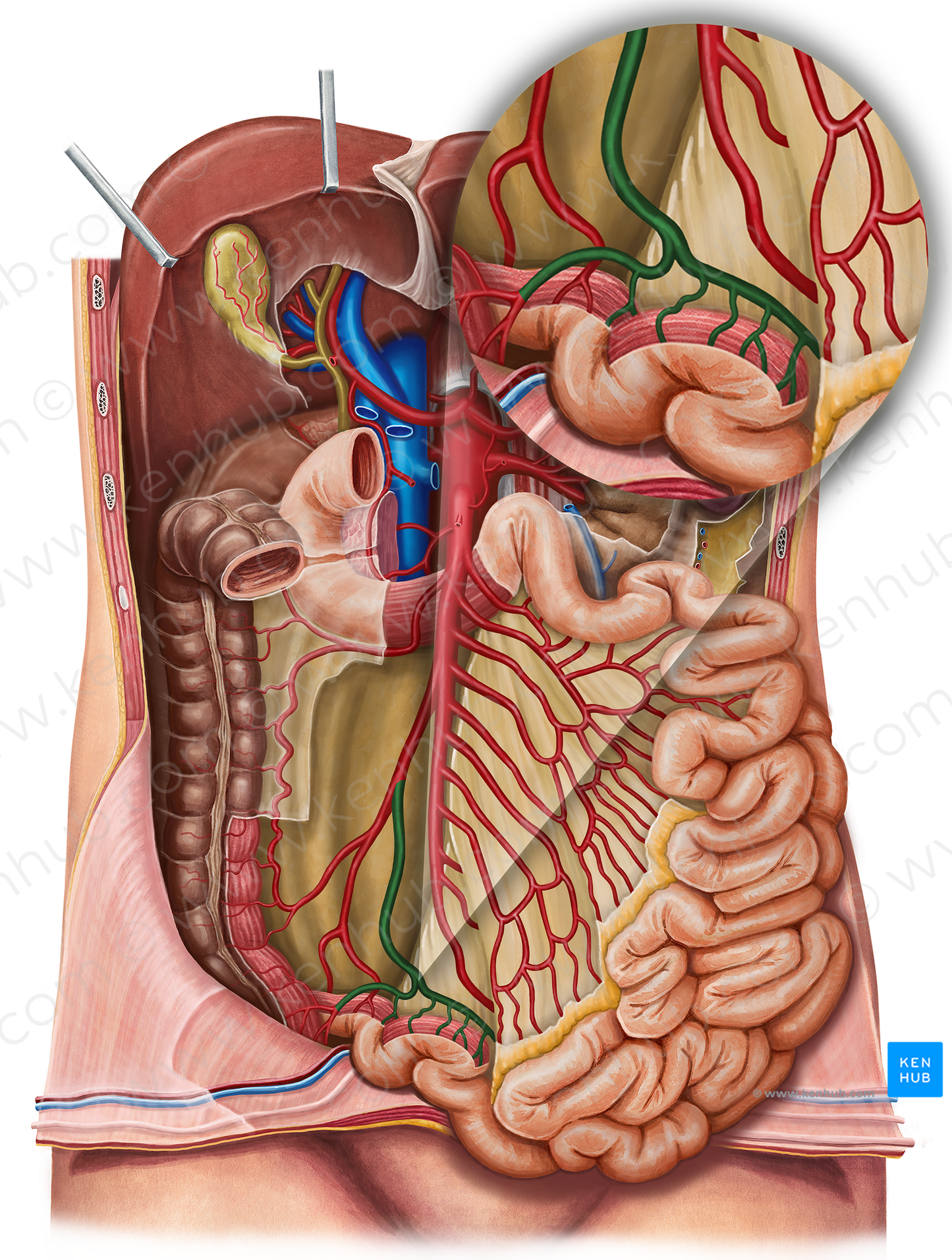 Ileal branch of ileocolic artery (#8694)