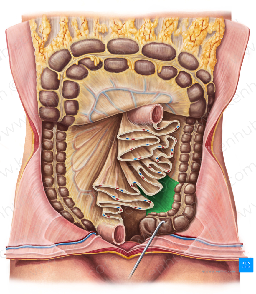 Sigmoid mesocolon (#5080)