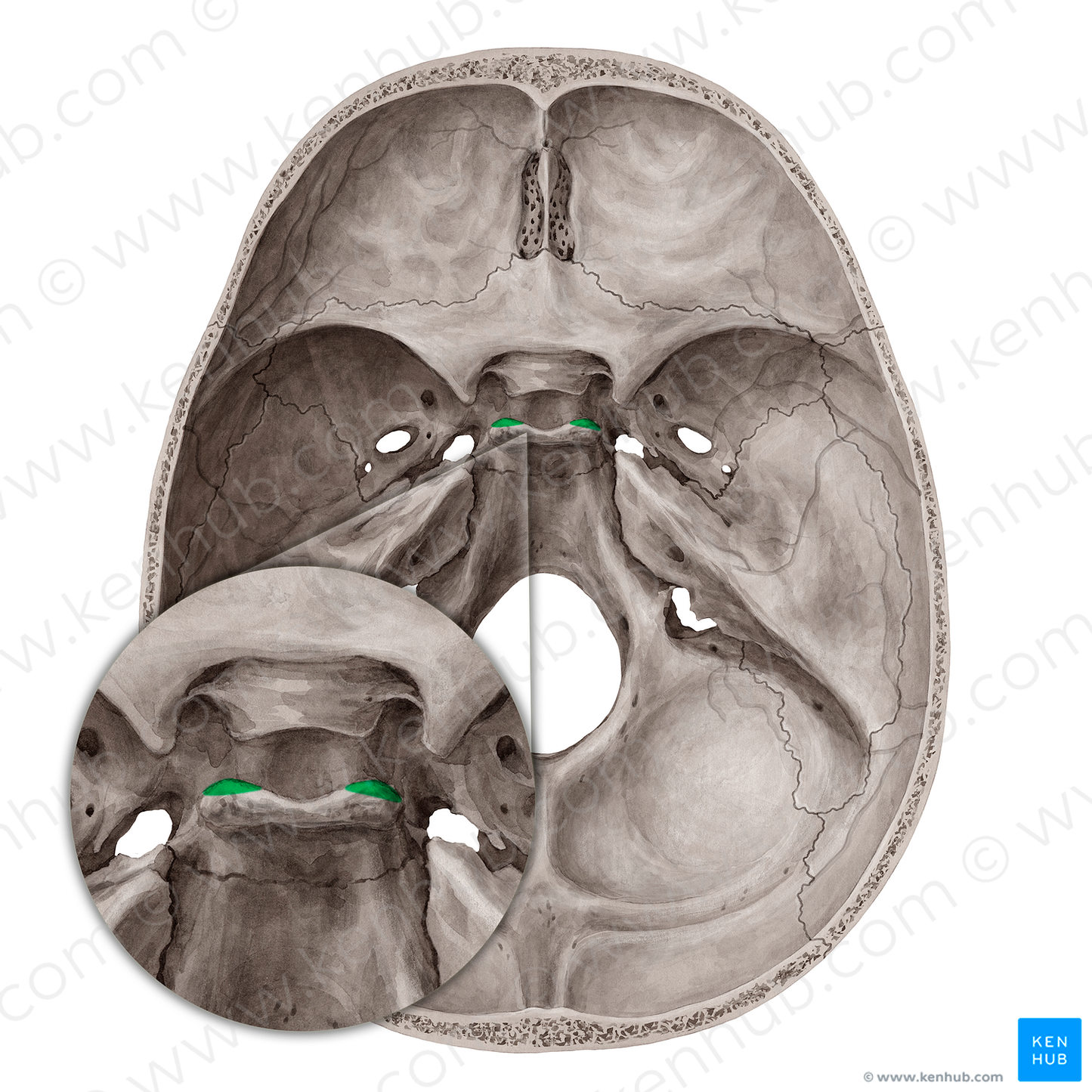 Posterior clinoid process of sphenoid bone (#8190)