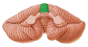 Central lobule of vermis (#4756)