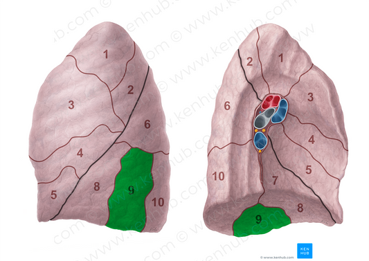Lateral basal segment of left lung (#20703)