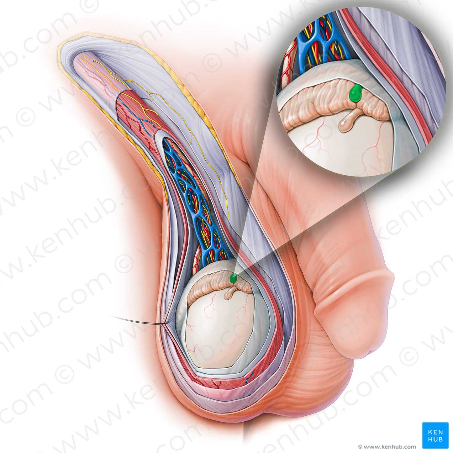 Appendix of epididymis (#15144)