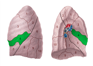 Superior lingular segment of left lung (#20700)