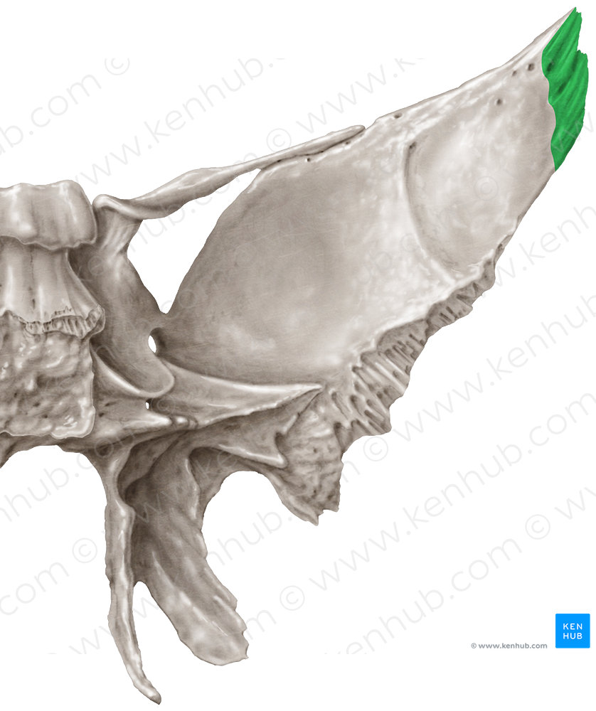 Parietal margin of greater wing of sphenoid bone (#4946)