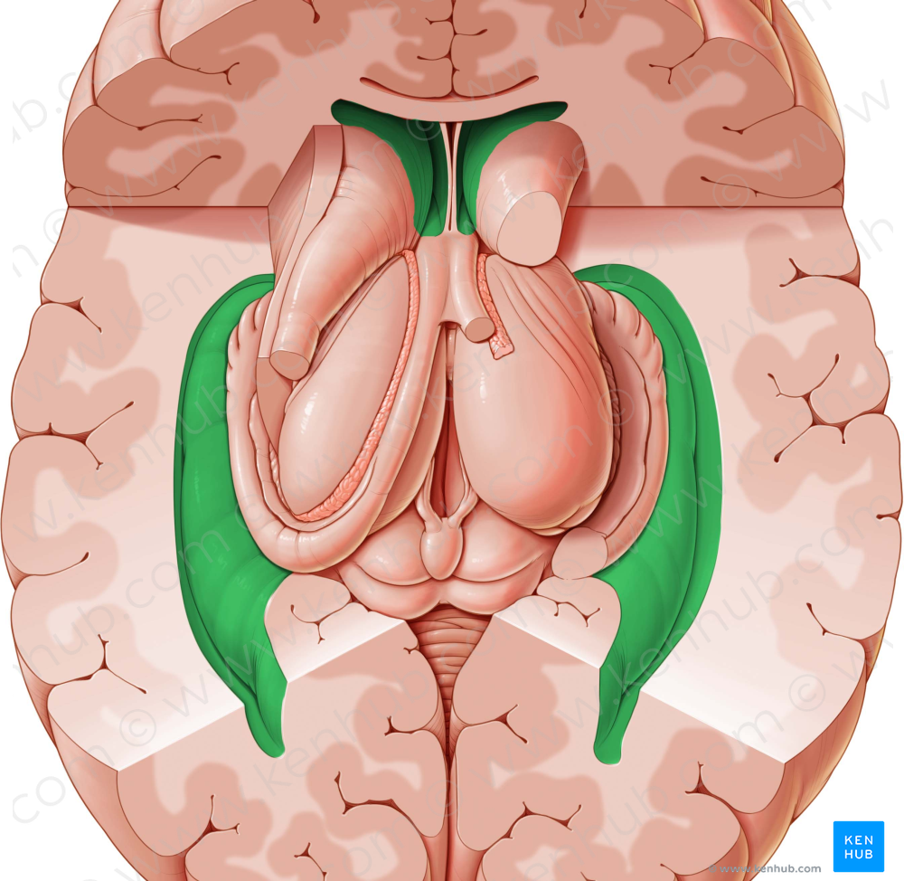 Lateral ventricle (#10710)