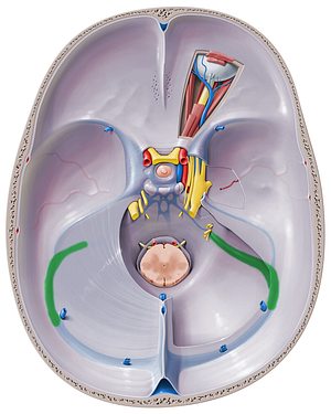 Sigmoid sinus (#9058)