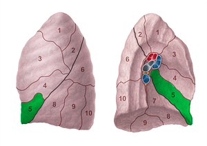 Inferior lingular segment of left lung (#20701)