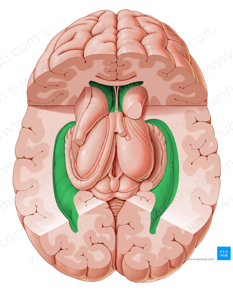Lateral ventricle (#10712)