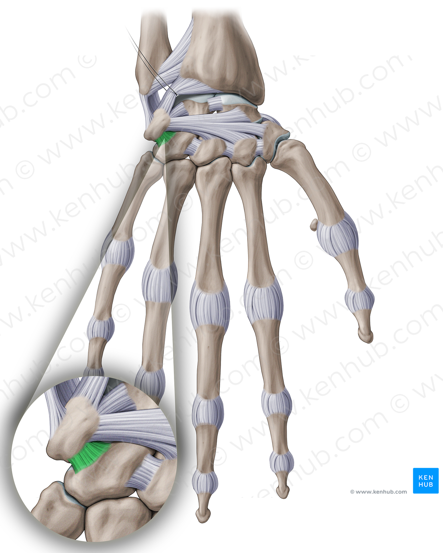 Dorsal triquetrohamate ligament (#18914)