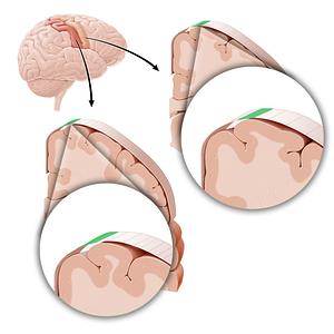 Sensory and motor cortex of trunk (#21231)