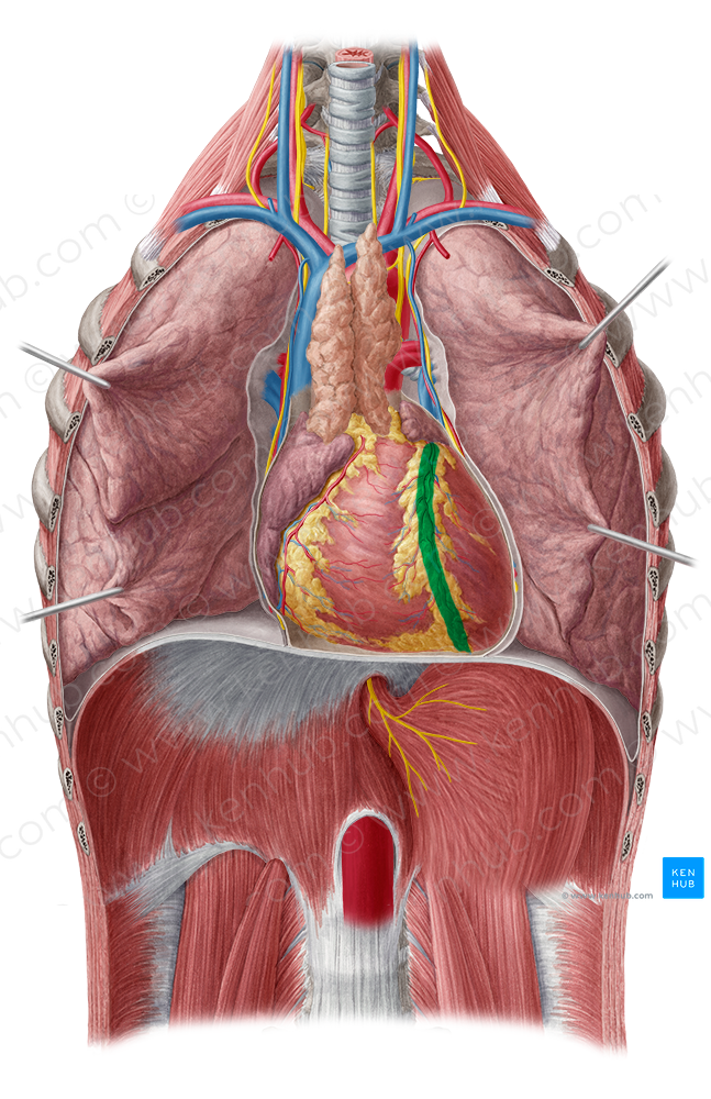 Anterior interventricular sulcus (#9268)