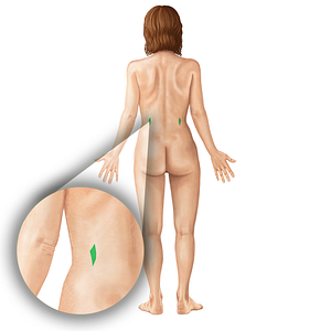 Superior lumbar triangle (#19843)