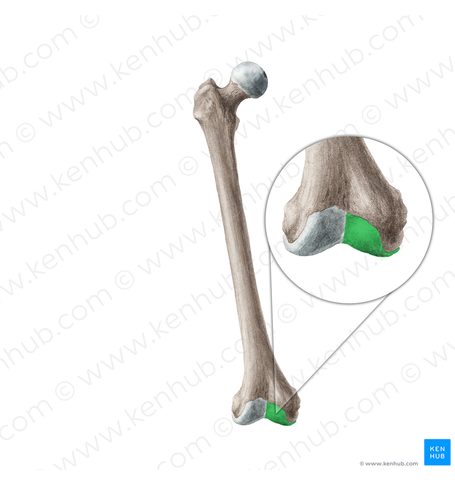 Medial condyle of femur (#19960)