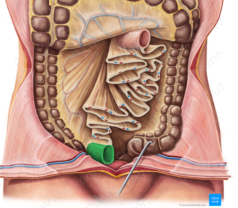 Ileum (#4263)