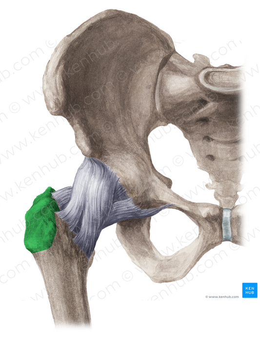 Greater trochanter of femur (#9574)