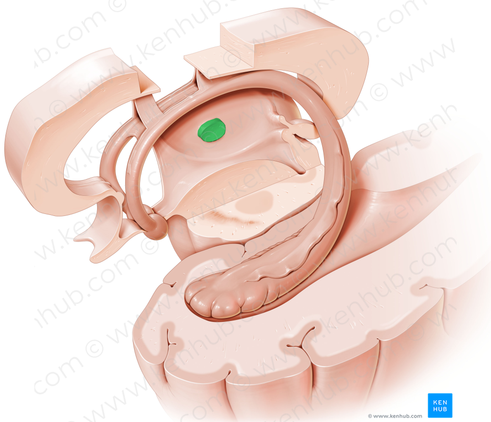 Interthalamic adhesion (#591)