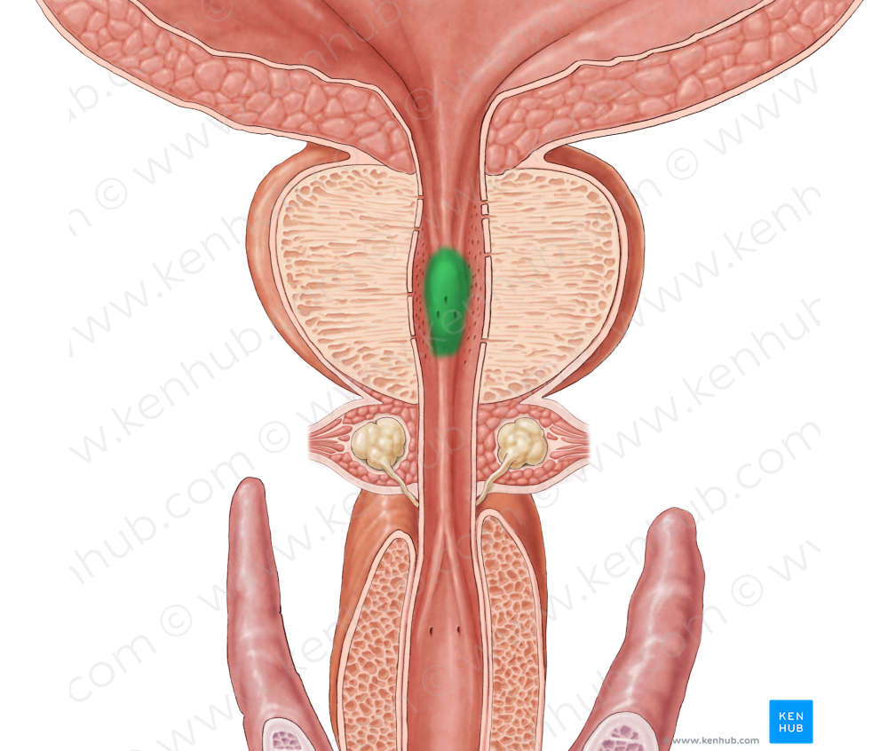 Seminal colliculus (#2662)