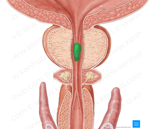 Seminal colliculus (#2662)