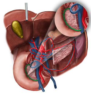 Anterior pancreaticoduodenal veins (#10461)