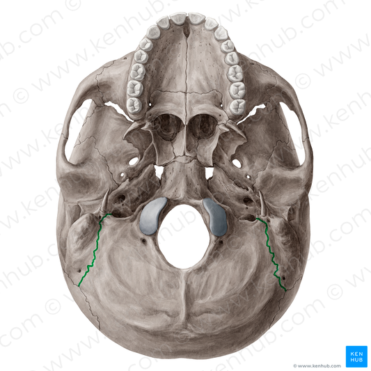 Occipitomastoid suture (#21536)