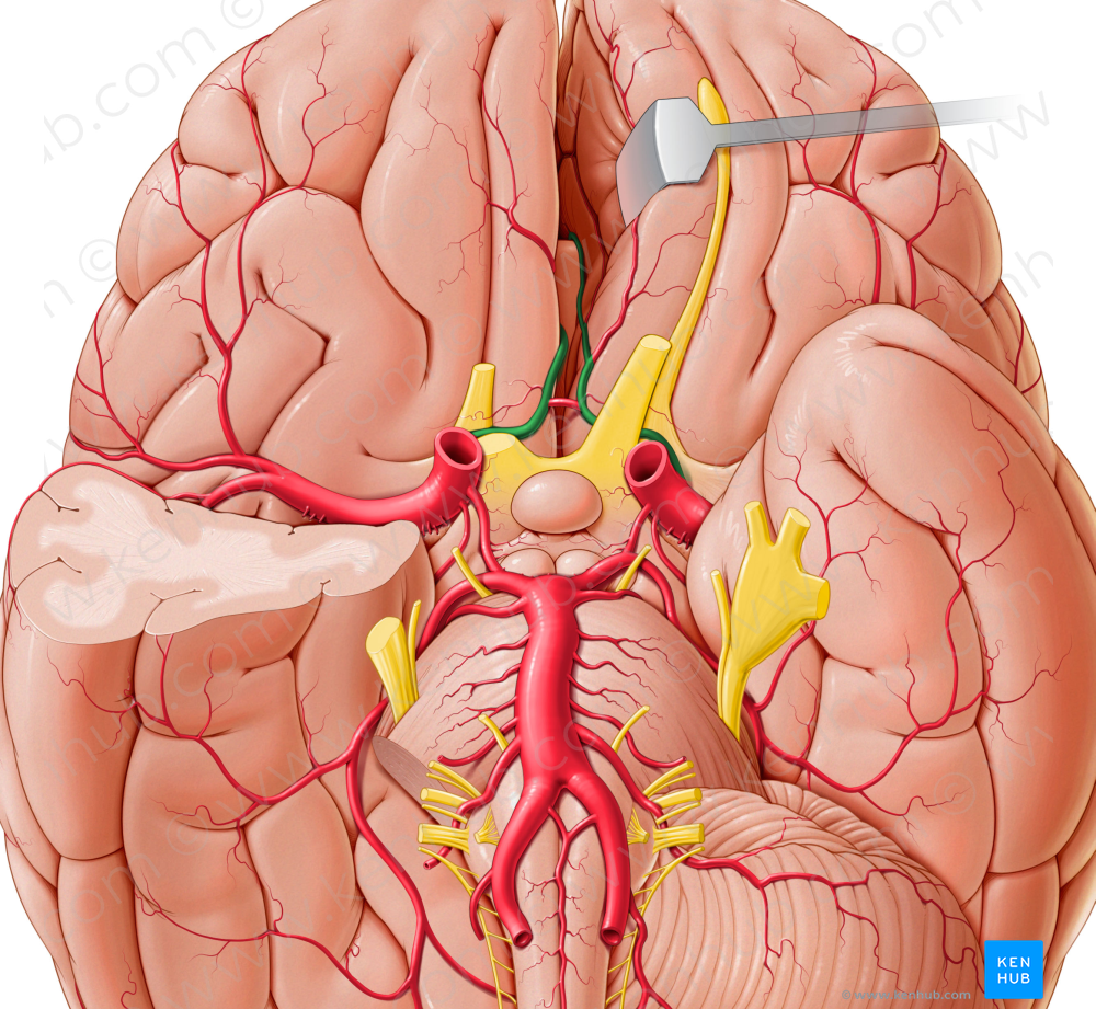 Anterior cerebral artery (#1008)
