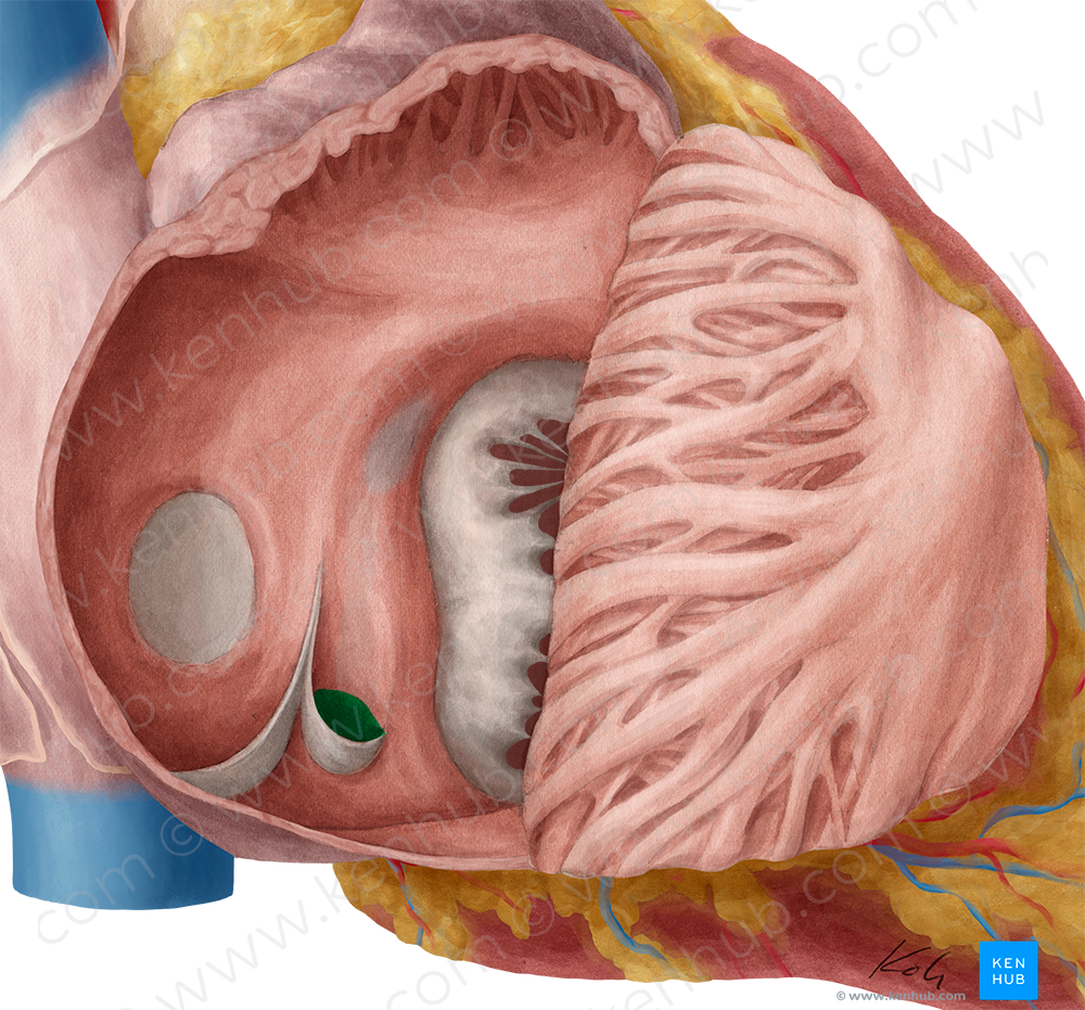 Orifice of coronary sinus (#7549)