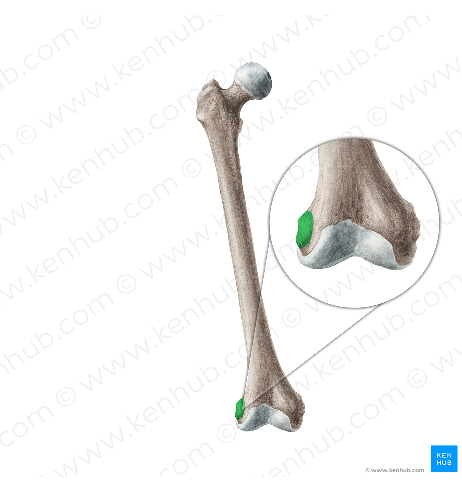 Lateral epicondyle of femur (#3393)