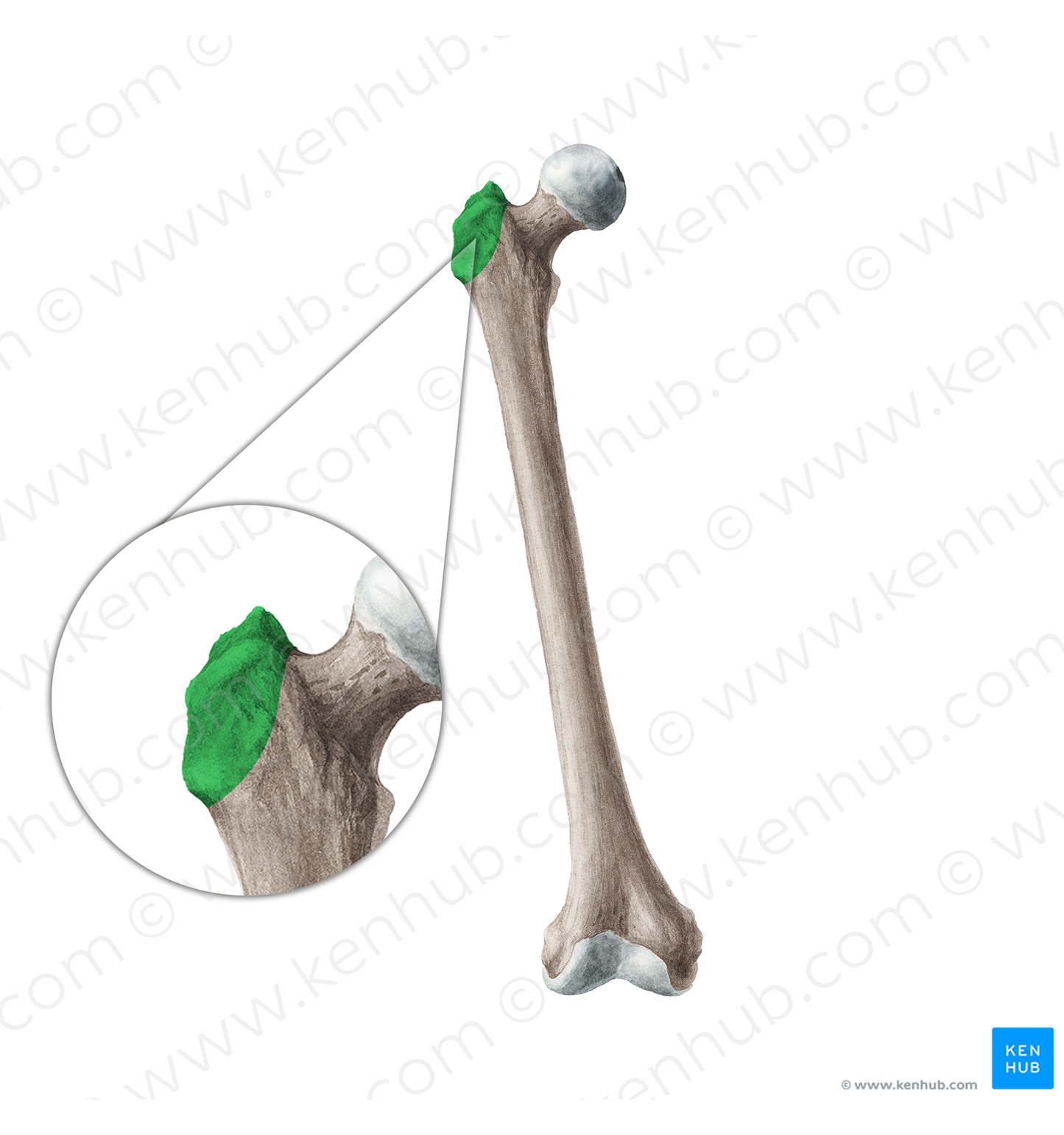 Greater trochanter of femur (#19950)