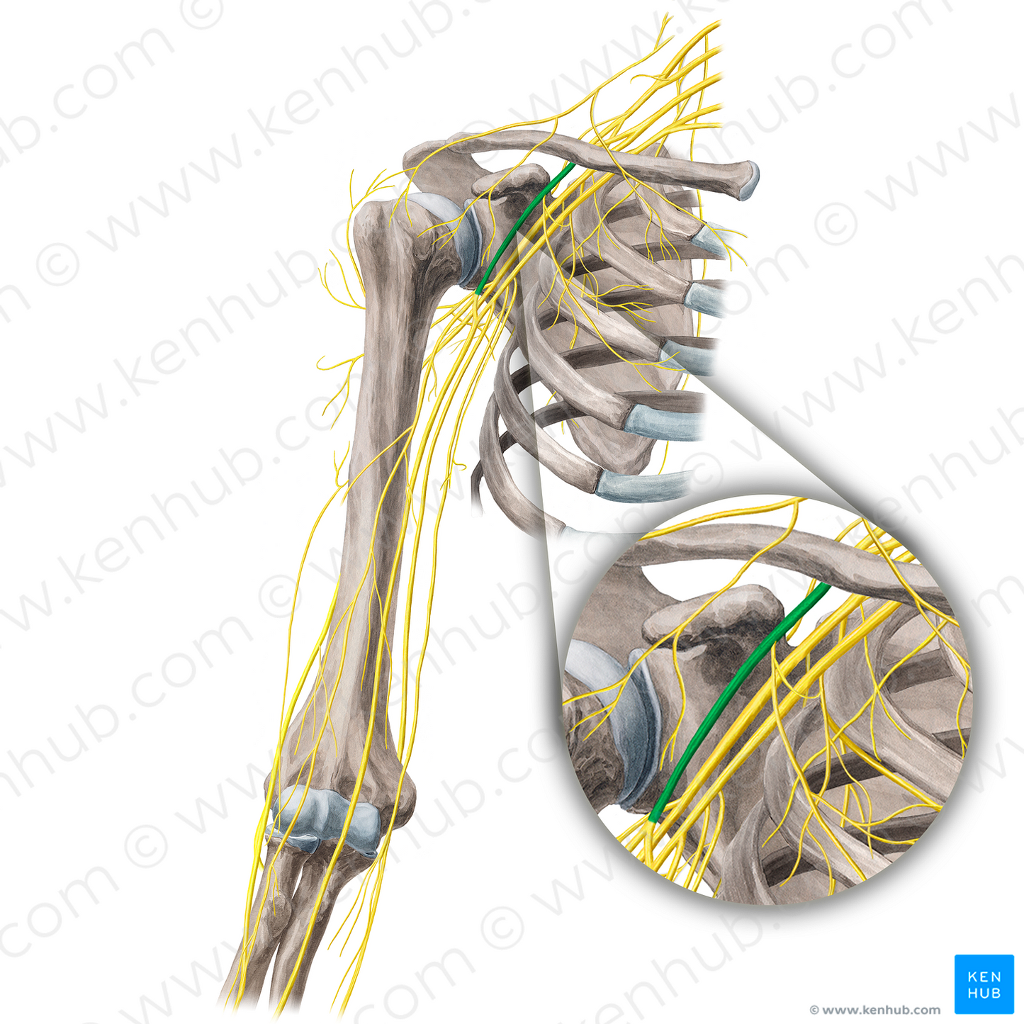 Lateral cord of brachial plexus (#3602)