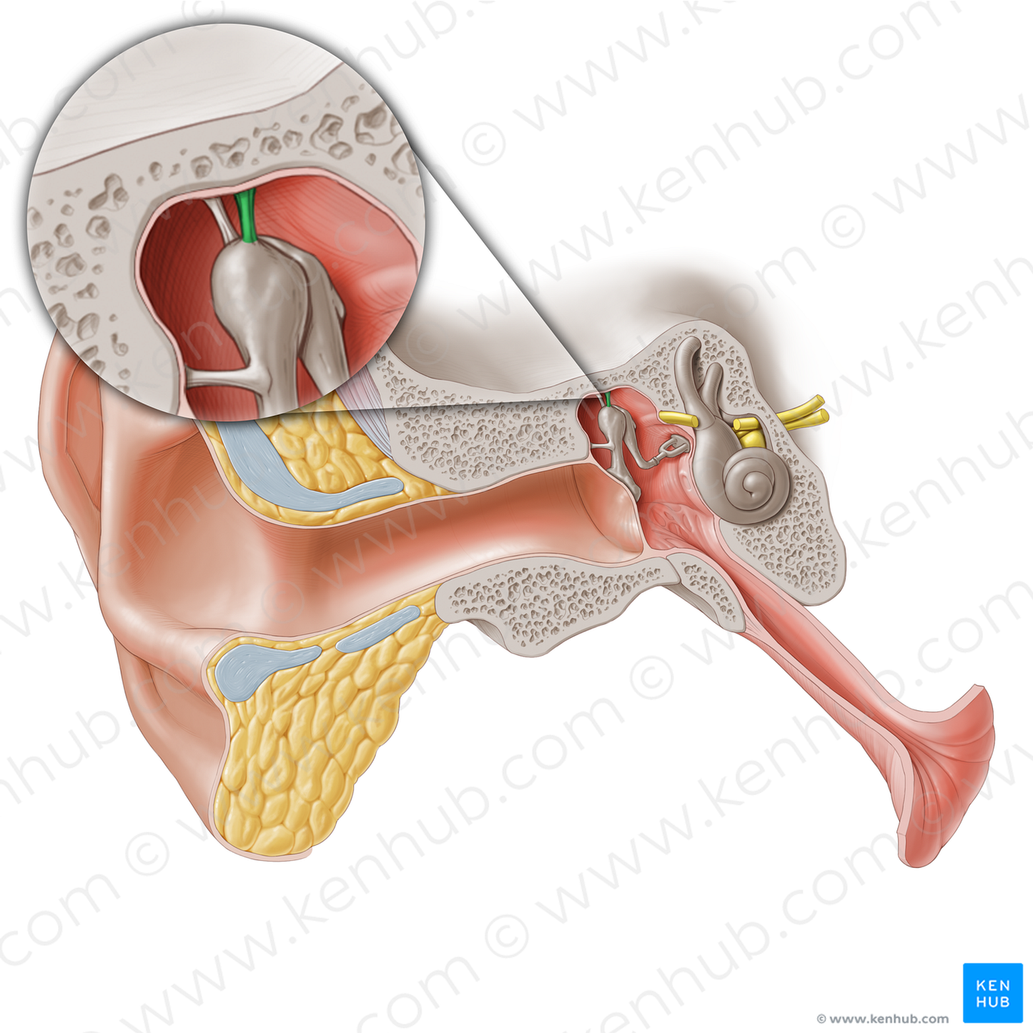 Superior ligament of malleus (#20273)