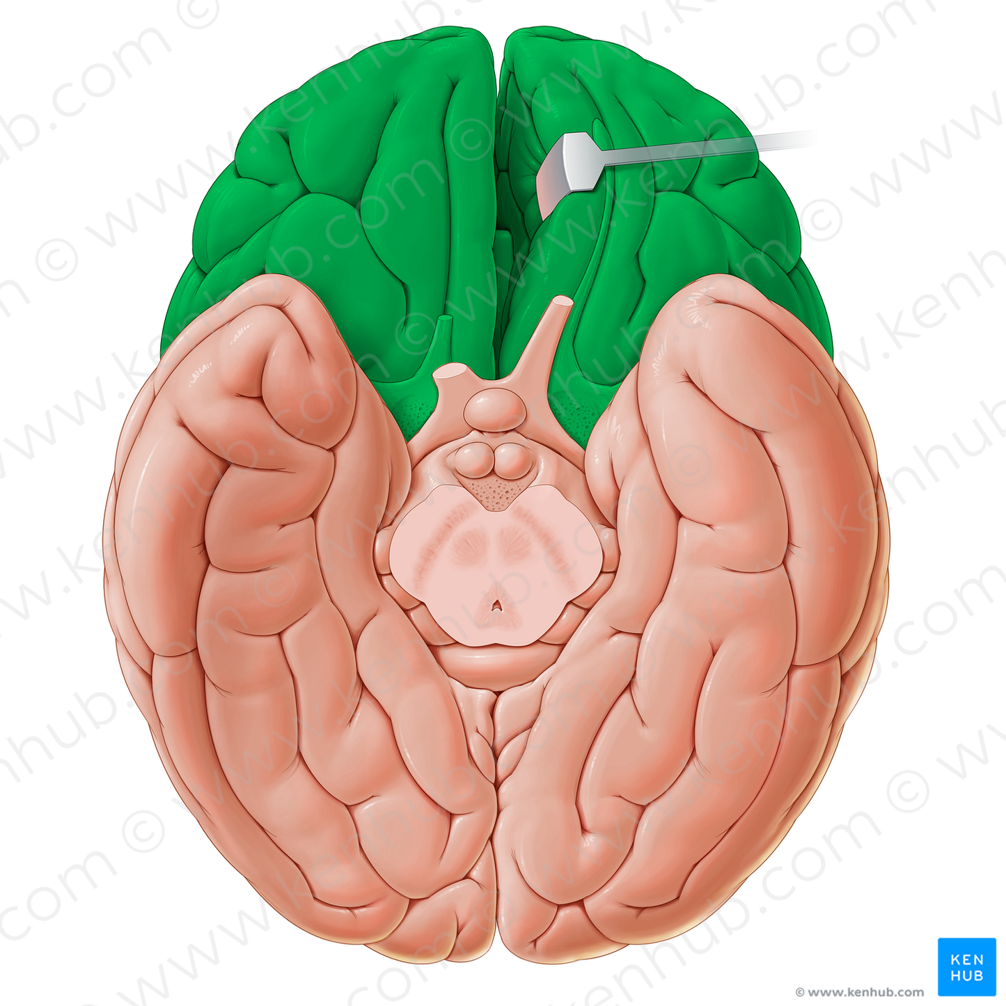 Anterior part of inferior surface of cerebrum (#20642)
