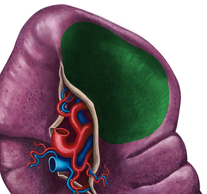 Gastric impression of spleen (#3498)