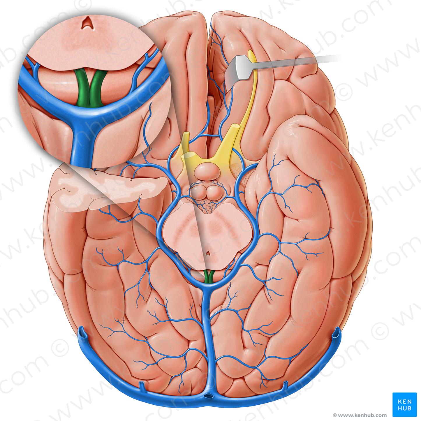 Internal cerebral veins (#18231)