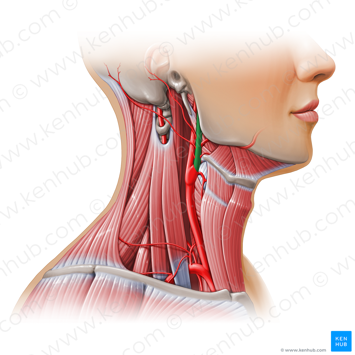 External carotid artery (#11133)