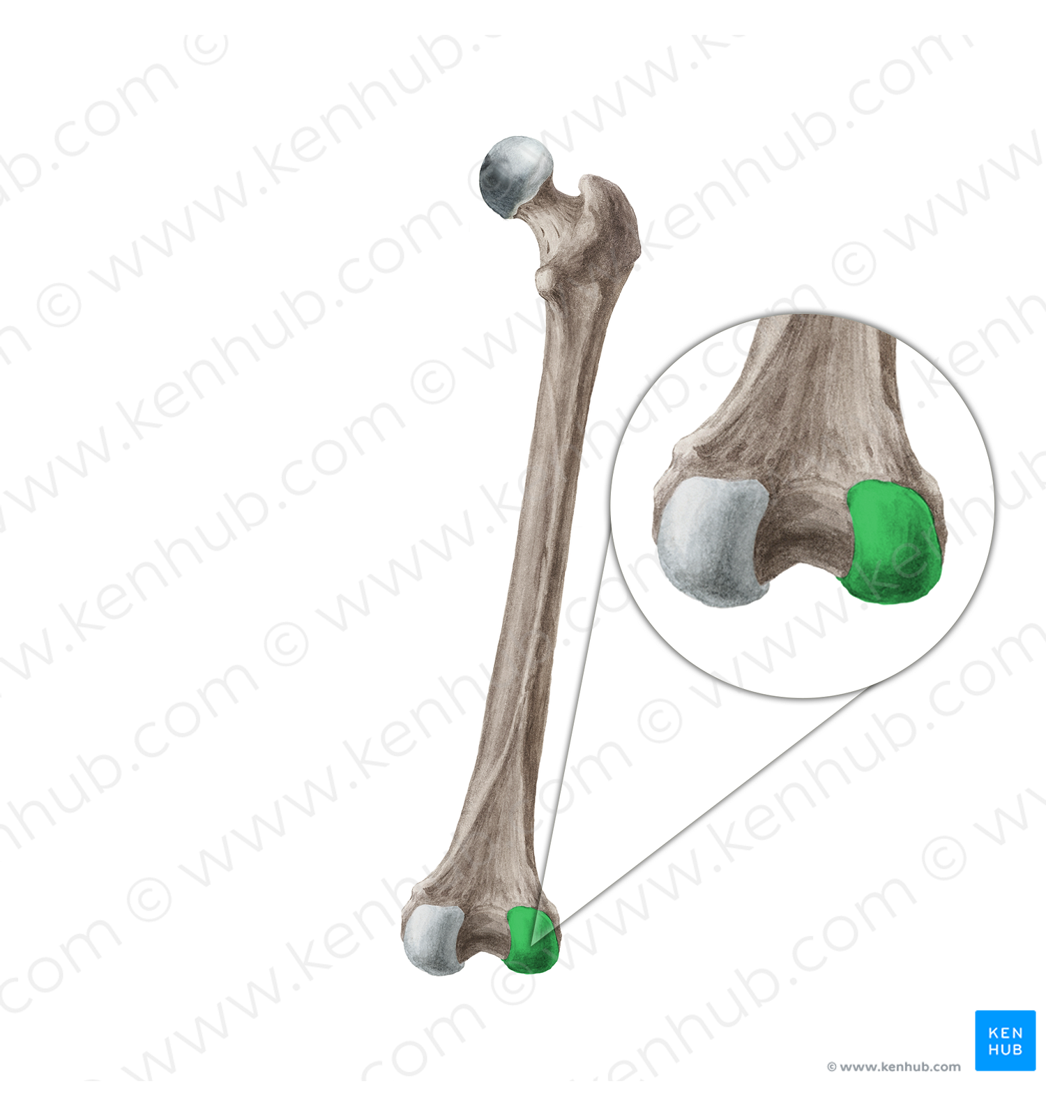Lateral condyle of femur (#2821)