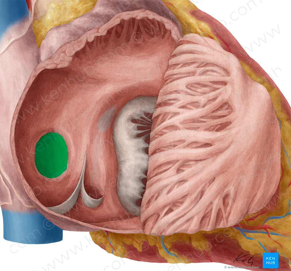 Fossa ovalis of right atrium (#3871)